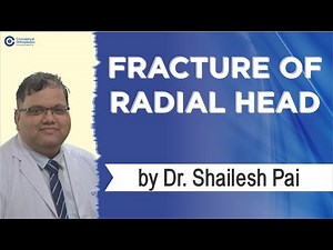 Fracture of Radial Head by Dr. Shailesh Pai ‪@ConceptualOrthopedics‬