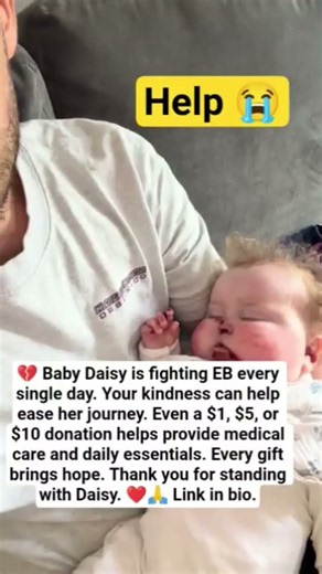 Every second counts. Please help Baby Daisy battle EB. A $20 or $50 donation helps