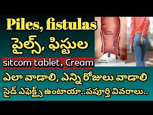 Piles easy treatment at home || How to use sitcom tablet & cream | Piles, pimples home treatment
