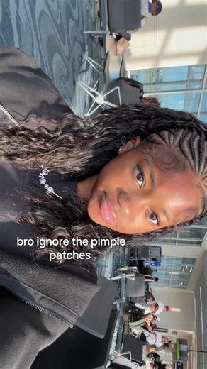 imsoovo1738 (@imsoovo1738)’s video of liquid pimple patch