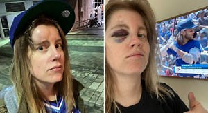 Major League Baseball fan hit in the face by 110-mph foul ball during game