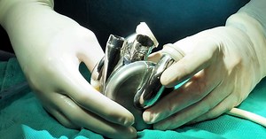 BiVacor Total Artificial Heart: the 200 Best Inventions of 2024