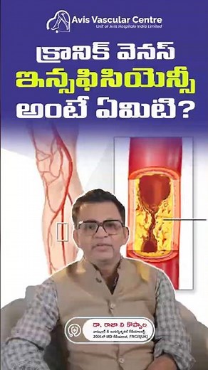 Why Different Vein Issues Require Different Treatments | Dr. Rajah V Koppala | Avis Hospitals