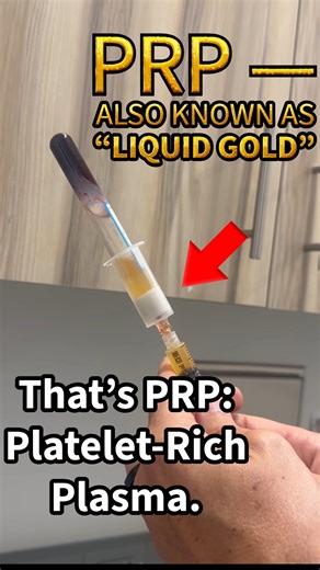 1.6K views |  What is PRP (Platelet-Rich Plasma)? Often called...