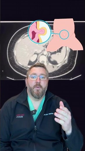 #Hernia CAT Scan with Dr. Anthony Gielow