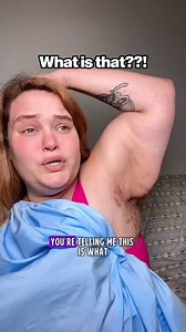 Think it’s acne? Think again. Painful lumps under your arms or groin could be Hidradenitis Suppurativa (HS) — a chronic skin condition that keeps coming back. 💡 Good news: Universal Flare Care can calm HS bumps in 24–48 hours. No steroids. No prescriptions. Backed up by our 30 Day Money Back Guarantee. | Mymagichealer
