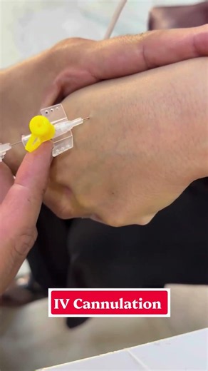 IV Insertion Technique: Simple #usnurse #IVCannulation #IVInsertion #Nursing #NursingStudents