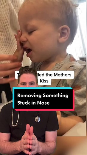 Effective Mother's Kiss Technique for Nasal Foreign Body Removal
