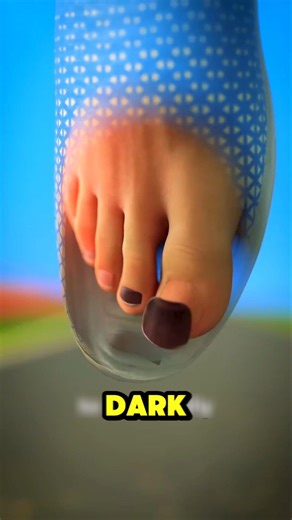 Why Some Runners Remove Their Toenails Before a Race🏃‍♂️