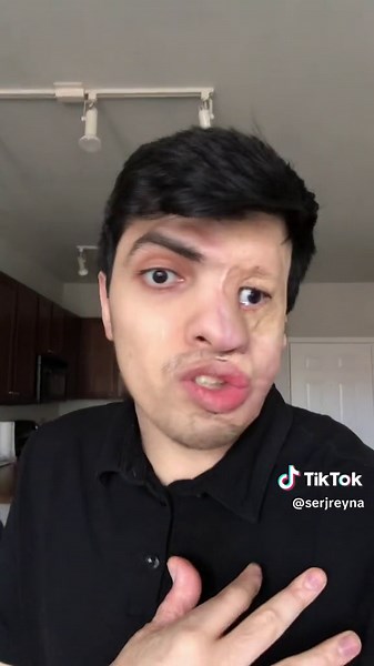 Surviving a Burn Accident - My Story Revealed