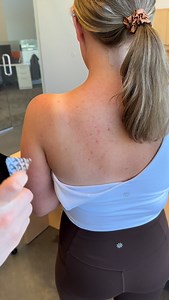 How to apply KT Tape for shoulder support. Designed for larger muscle groups, KT Tape Pro Wide can help provide support during your workouts, sports and daily activity. #kttape #shoulderpain #shoulderstability | KT Tape