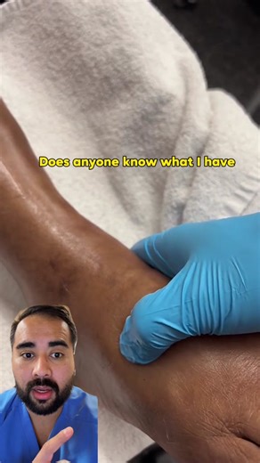 Understanding Swollen Legs: Causes and Remedies Explained