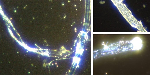 Darkfield Microscopy of Canine Distemper - Adenovirus Parainfluenza-Parvovirus Vaccine - Routine Vaccination For Dogs Shows Microbots and Polymer Self Assembly
