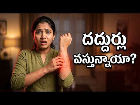 ఫుడ్ అలెర్జీ వల్ల దద్దుర్లు వస్తున్నాయా? | Allergy Rash Treatment Telugu | Dr. Pavushetty Sreedhar
