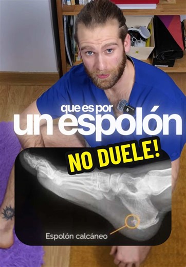 Dolor de talón: fascitis plantar vs espolón calcáneo
