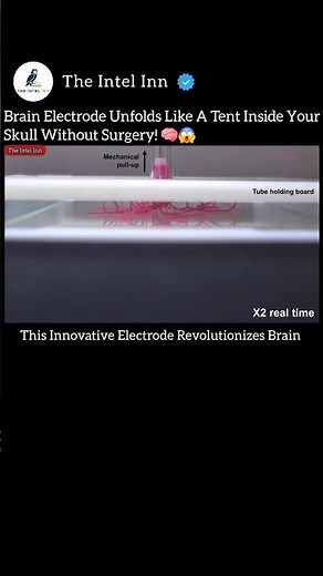 Brain Electrode Unfolds Like A Tent Inside Your Skull Without Surgery 🧠😱 #Robotic #Innovative