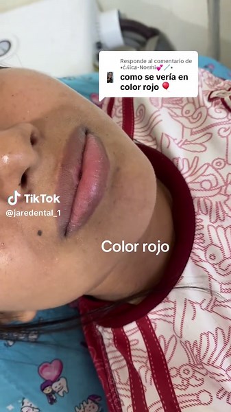 Colores de Brackets en Ortodoncia: Guía Completa