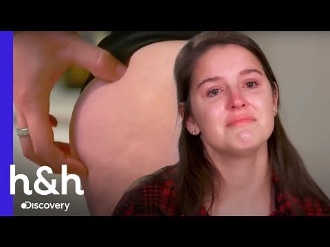 ¿Qué hace ese raro bulto en un glúteo? | Dra. Sandra Lee: Especialista en piel | Discovery H&H