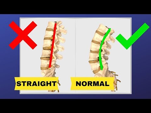 How To Correct Straightening Of Lumbar Spine (FIX LOSS OF LUMBAR LORDOSIS) | Dr. Walter Salubro