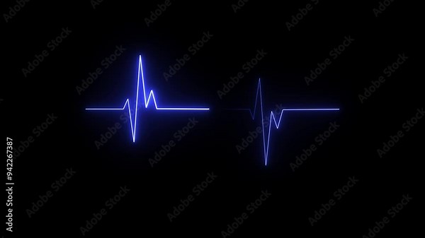 ECG cardiogram oscilloscope. Heartbeat line showing.Heart beat cardiogram.