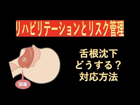 リハビリテーションとリスク管理-舌根沈下とは？対応方法は？