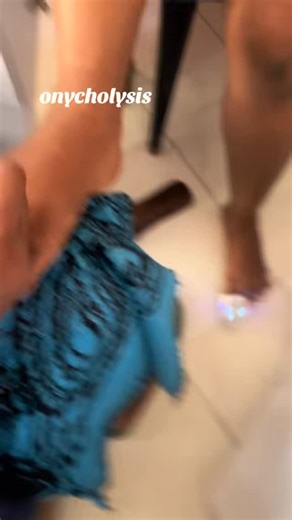 it’s called onycholysis. It’s pretty common, especially if you do...