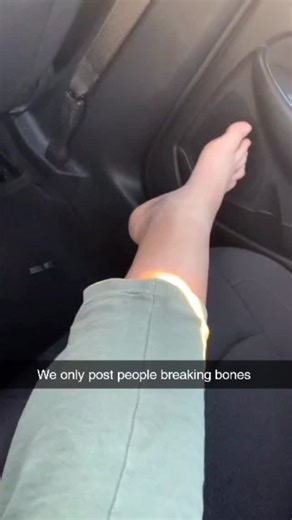 Watch People Break on Instagram: "Imagine if there was a page dedicated to people breaking bones... @cblez - Follow for 🔥🔥🔥 sports picks Music by: @alesso - Destiny #BreakdownMoments #EpicFails #BreakingPoint #MentalBreakdown #PhysicalCollapse #ExtremeAccidents"