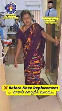 మోకాలి మార్పిడి తర్వాత ఎలా అనిపిస్తుంది? ⏩ 2.5 Years After Knee Replacement. ✅ Sub-Vastus Approach