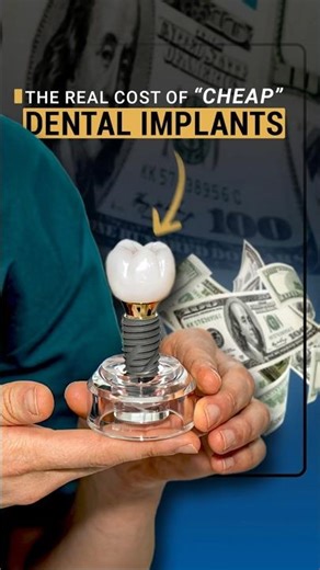 The Truth About “Cheap” Dental Implants ❗ | What You Need to Know