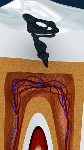 Replace missing teeth: Discover your options at our Live Online Teeth Replacement Info Evening with our special guest speaker Dr Bobby Chhoker from Sydney. Here’s what you’ll learn: ✅ Get an in-depth and honest look at the different options for replacing missing teeth. ✅ See exactly how each treatment works, the process patients go through and the outcomes they experience. As well as who may be eligible for these treatments. ✅ Our guest speaker Dr Bobby will discuss the range of issues patients 