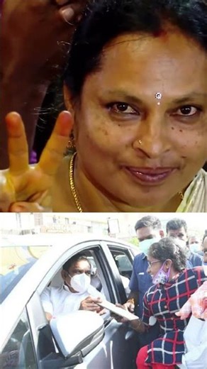 வரலாற்றிலே செயற்கை கை பொருத்தியது முதன் முதலில் அதிமுக ஆட்சி காலத்தில் தான்