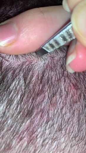 pluckytweeze on TikTok