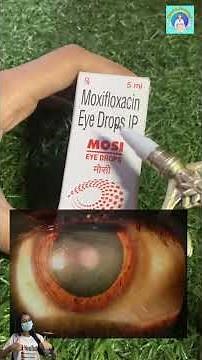 Moxifloxacin Eye Drops – REAL Uses 🔥👁️ @thepharmagirll