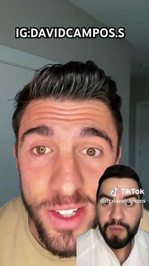 Protesis ocular de 10 mil dolares #protesisdeojo #protesisocular