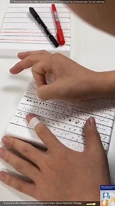 This injection #facts #dailyfacts #tretment | Facteon