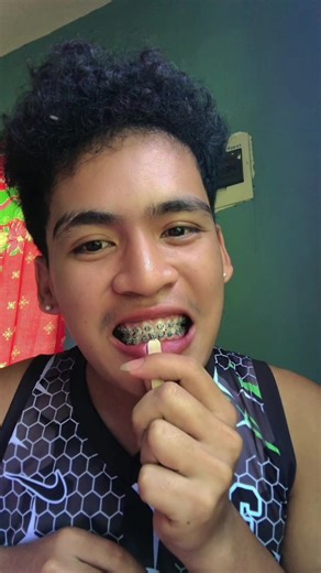 DIY Braces Ideas and Tips for Perfect Teeth