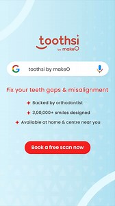 1.8K views | Don’t let your misaligned teeth hold you back! Try Toothsi invisible aligners, now with the perfect smile deal. Book a scan to get started. ✅Toothsi guarantee provided ✅Easy to wear ✅EMIs starting at ₹1499/month ✅More than 3Lakh+ smiles designed ✅ US FDA approved | toothsi by makeO | Facebook