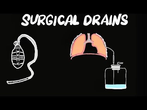 Surgical Drains-Types, Classification, Uses, Indications,Complications