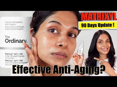 Maximum Anti-Aging - How to use Matrixyl in Skincare? (3-month update)