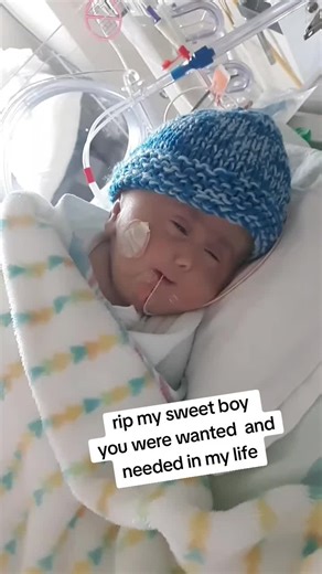 Jordan was born with a rare life threating condition called Holoprosencephaly. i found out at my 20 week anatomy scan he was in nicu for 7 weeks and I got him home for 1 week and he passed away in my arms😢😢 hardest thing i ever went thur. im so sorry i couldnt save you #childloss #angelson #grieveingparents #grievingmom #holoprosencephaly