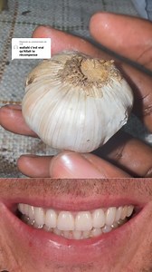 Menuiserie D'Aluminium on Reels