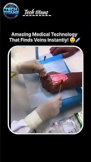 AI makes vein detection faster and easier! 💉🚀 #MedicalTech #science #viralvideo