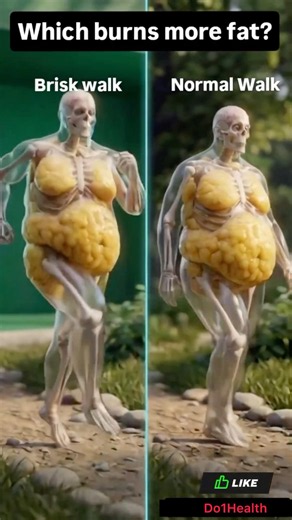 Walk vs Normal Walk: Which One Melts More Fat? 😱🔥