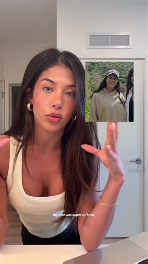 Exploring PCOS and Birth Control Answers