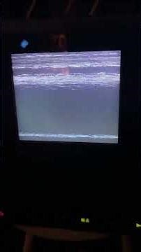 Another Rare Public Domain VHS Closing!