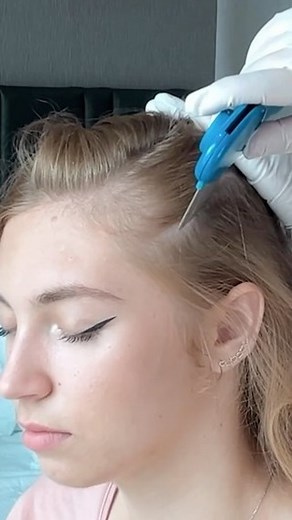 Mad P ASMR | ASMR scalp inspection 🧐 for sleep #asmr #asmrsounds #asmrvideo | Instagram