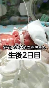 早産 22週 572gで生まれた赤ちゃんの成長記録 生後2日目（妊娠22週6日 時期）