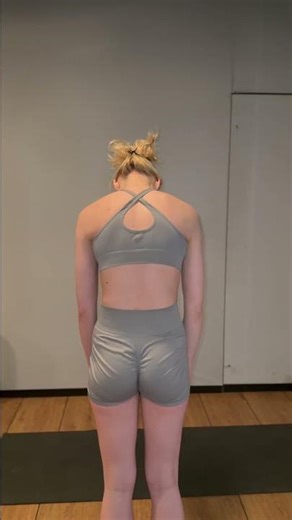 Back View Forward Bend Test for Scoliosis Rotation (Angle 2) - SpineX