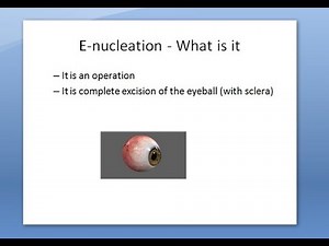 Ophthalmology 316 a Enucleation Removal Eye Ball evisceration difference PMMA Medpor HydroxyApatite
