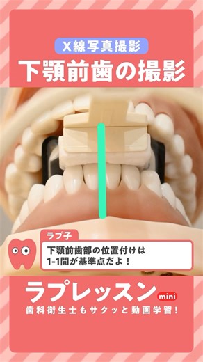 ラプレッスン on Instagram: "＼下顎前歯、インジケーター下向いてない？／ 切縁が合わない、角度がズレる… その撮りにくさ、噛ませる位置で変わるかも◎ ポイントは、 ✔️ フィルムは縦向き＋バイトピースは潰さない ✔️ 1・1間を中央に合わせる位置づけ ✔️ 切縁とバイトピースをぴったり合わせる！ インジケーターが下向いてしまう時は、 少し手前側で噛んでもらうのがコツ。 このレッスンは、 ラプレッスンに登録すれば誰でも視聴できます。 ＼「ラプレッスン」で検索🔍／"